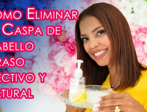 Como Eliminar La Caspa de Cabello Graso, Remedio Natural, Efectivo y Economico